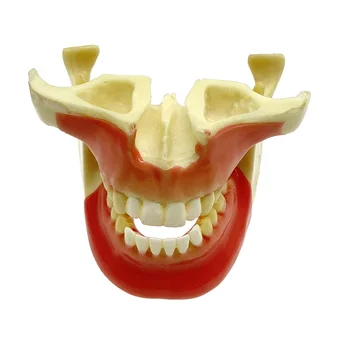 Стоматологический кабинет, модель для практики ортоимплантации, обучающее упражнение для студентов-врачей, демонстрационная модель патологических зубов.